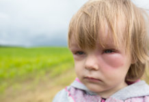Die Augengrippe: Symptome, Folgen & Vorbeugung