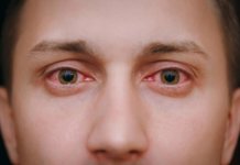 Augenentzündungen: Wichtige Erkrankungen im Überblick