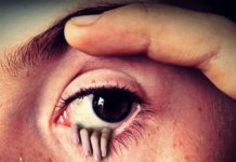 Fremdkörpergefühl bei Kontaktlinsen: Ursachen Fremdkörpergefühl bei Kontaktlinsen