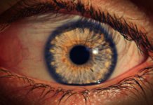 Hornhautentzündung (Keratitis): Symptome, Ursache & Therapie Hornhautentzündung (Keratitis)