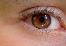 Ablagerungen auf Kontaktlinsen: Reinigung ist das A und O
