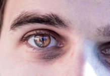 Augen lasern bei Hornhautverkrümmung: Behandlungsmöglichkeiten, Voraussetzungen und Grenzen augen lasern hornhautverkrümmung