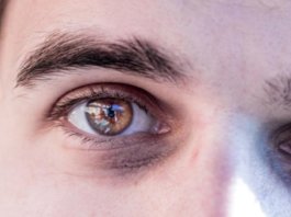 Augen lasern bei Hornhautverkrümmung: Behandlungsmöglichkeiten, Voraussetzungen und Grenzen augen lasern hornhautverkrümmung